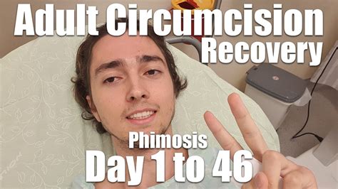 reddit circumcision|adult circumcision recovery reddit.